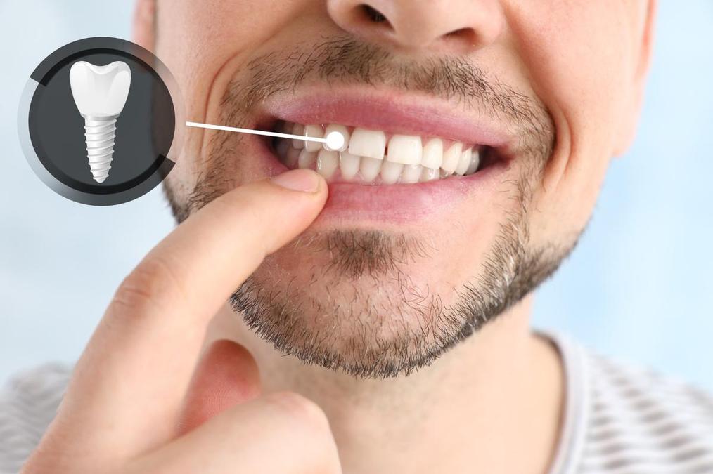 a man is pointing at his teeth with his finger .