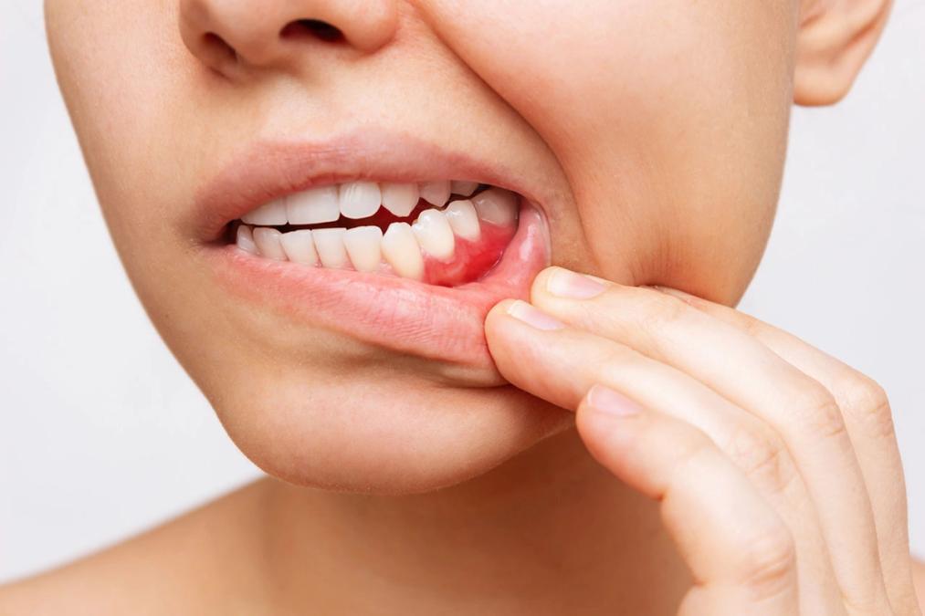 a woman is holding her mouth in pain because of a toothache .