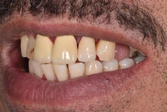 a close up of a man 's teeth with a beard .