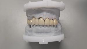 a close up of a model of a person 's teeth on a table .