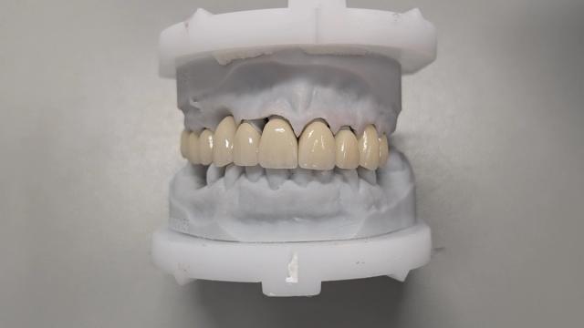 a close up of a model of a person 's teeth on a table .