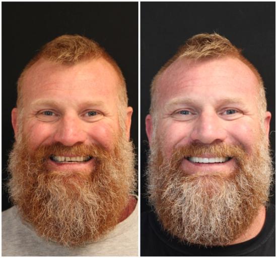 a man with a beard is smiling in a before and after photo .