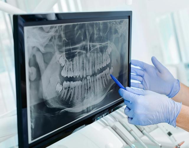 a dentist is looking at an x-ray of a person 's teeth on a computer screen .