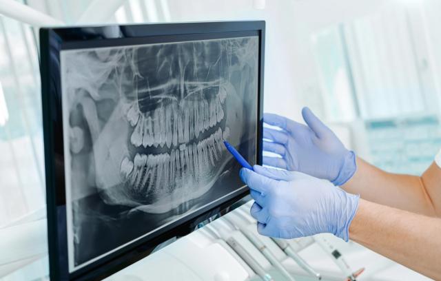 a dentist is looking at an x-ray of a person 's teeth on a computer screen .