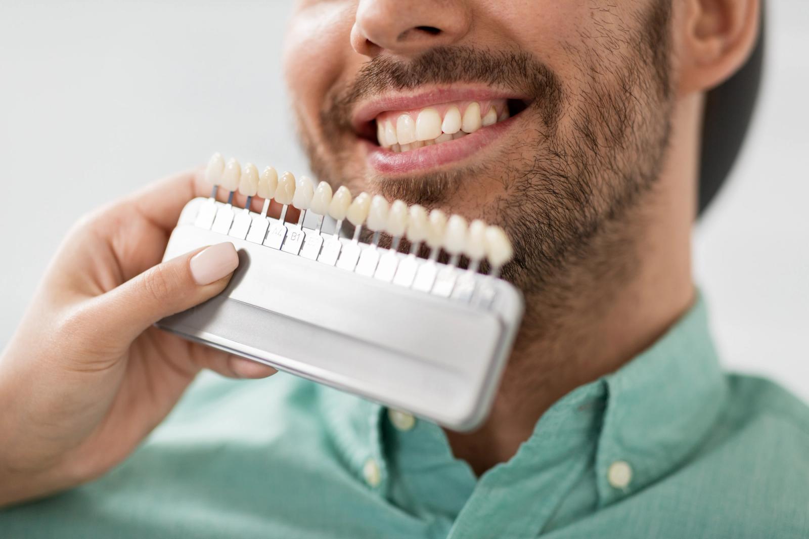A hand holds a dental shade guide next to a smiling man's teeth.