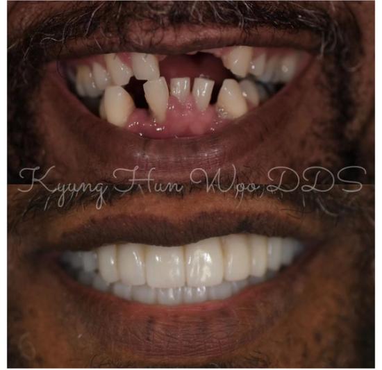 smile gallery photo 18