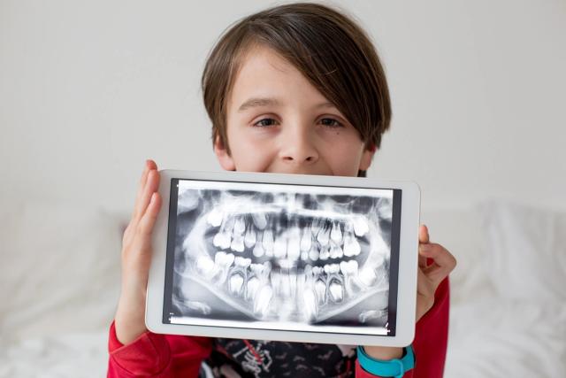a young boy is holding a tablet with an x-ray of his teeth on it .