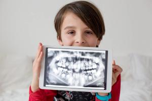 a young boy is holding a tablet with an x-ray of his teeth on it .
