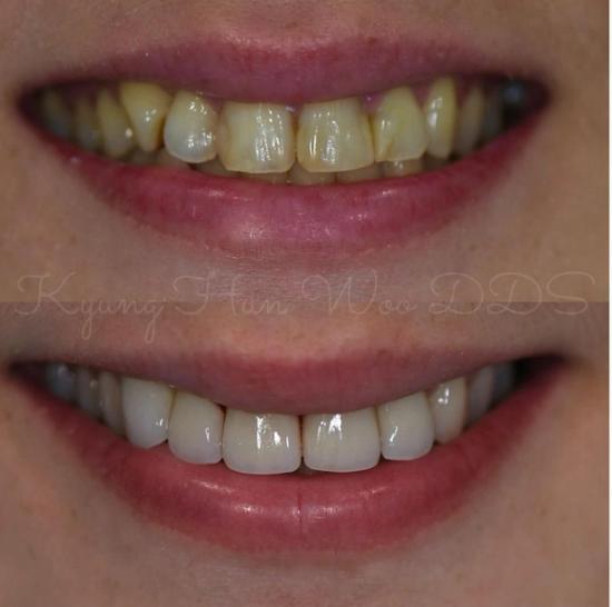 smile gallery photo 13