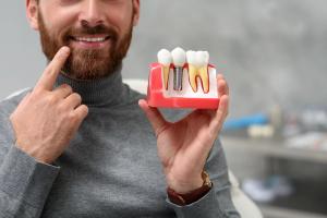 a man is holding a model of a dental implant in his hands .