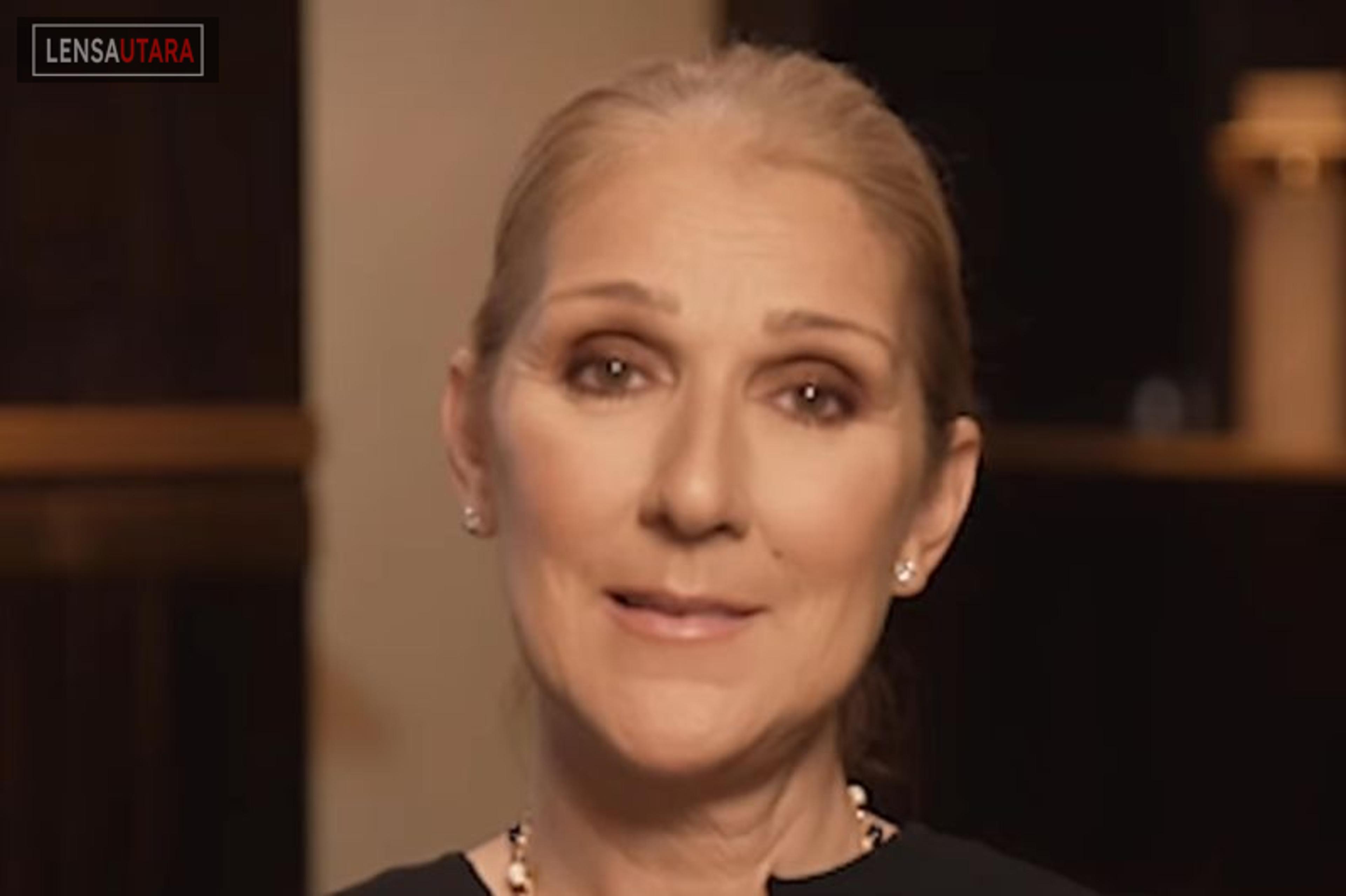 Celine Dion Alami Gangguan Saraf Langka