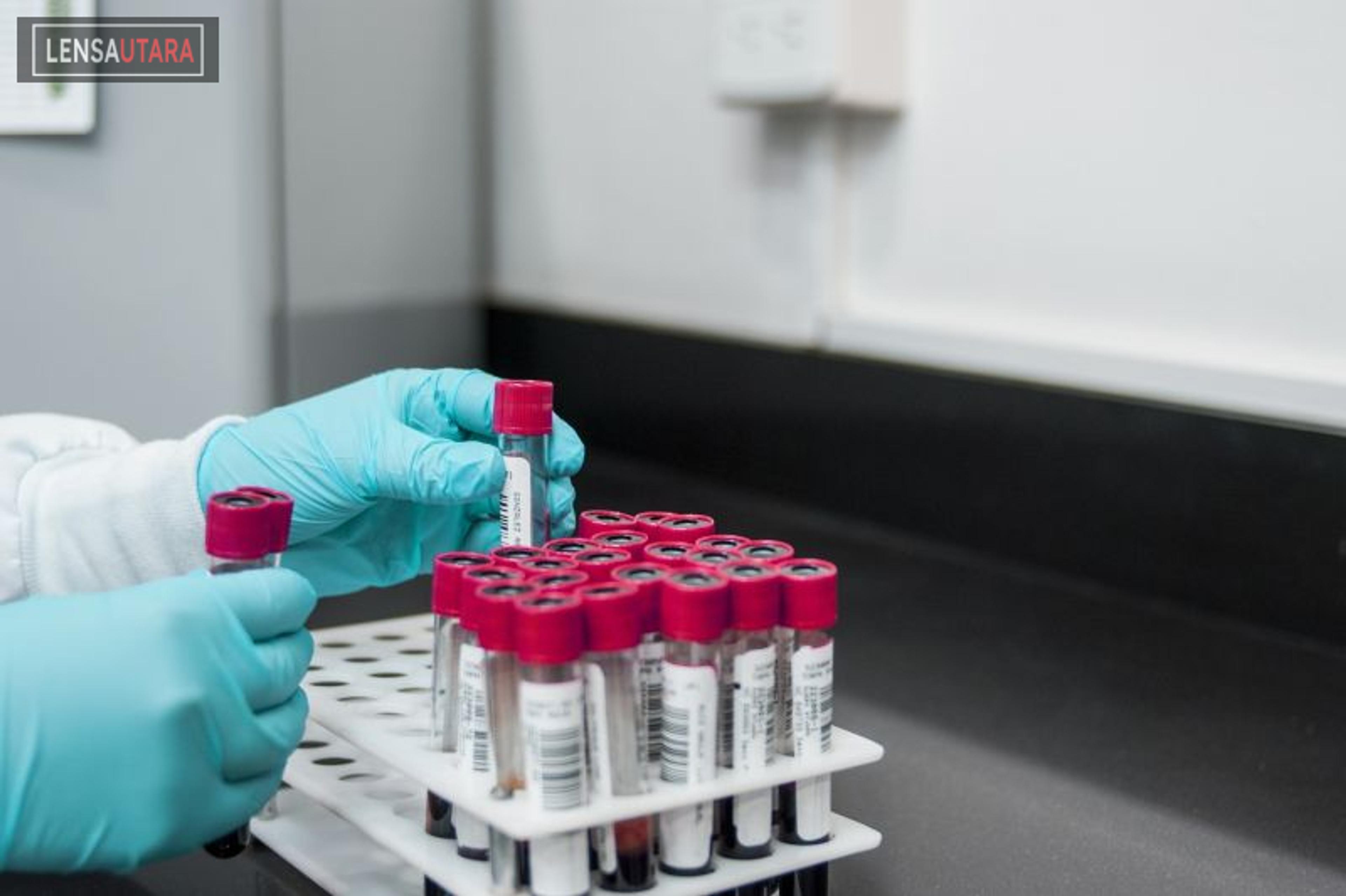 Dokter: Pastikan Ginjal Sehat dengan Pemeriksaan Urine dan Darah