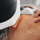 Lumecca IPL Photofacial