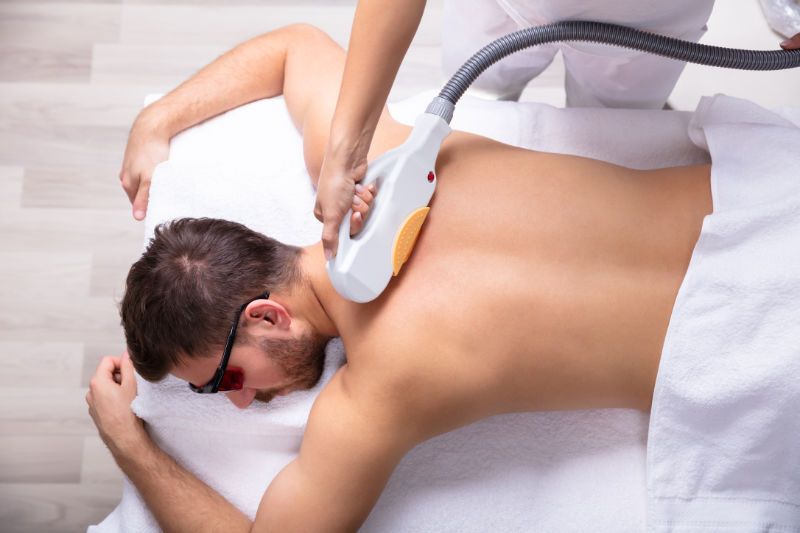 Laser Hair Removal for Men