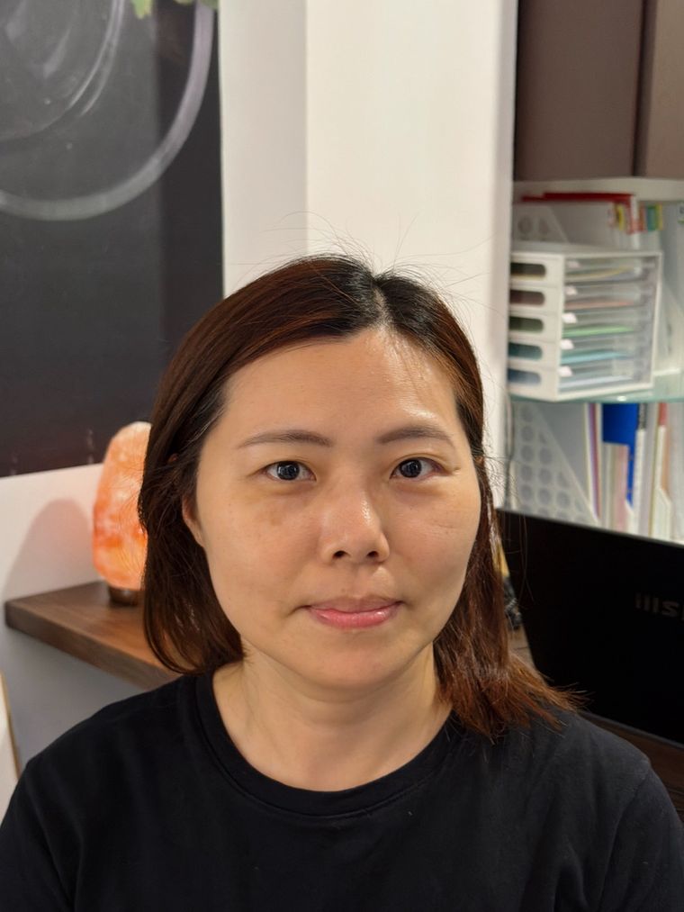 體驗前的正面與側面。下顎到脖子那條線有點糊,姊姊自己都認熬夜外食把臉養鬆了。
