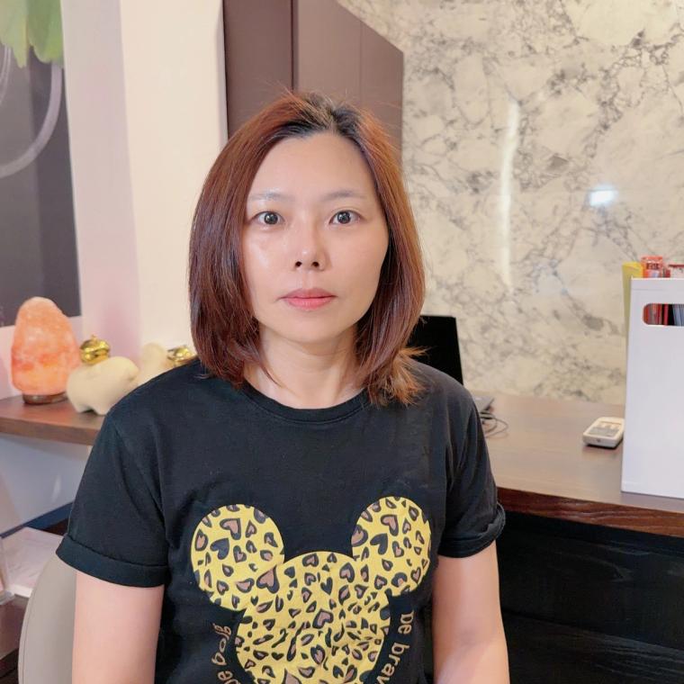 完工後拍了好幾張：兩頰不糊了、下顎線俐落，膚況亮一階。同一面牆、沒開濾鏡，對比才真實。