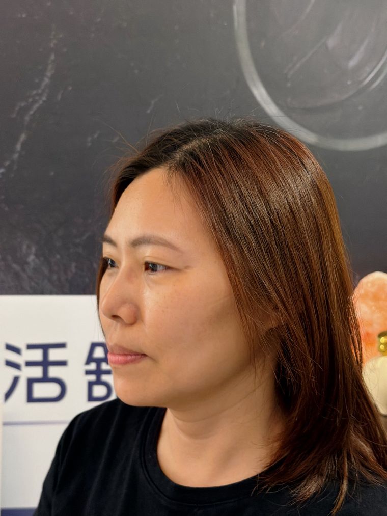 體驗前的正面與側面。下顎到脖子那條線有點糊,姊姊自己都認熬夜外食把臉養鬆了。