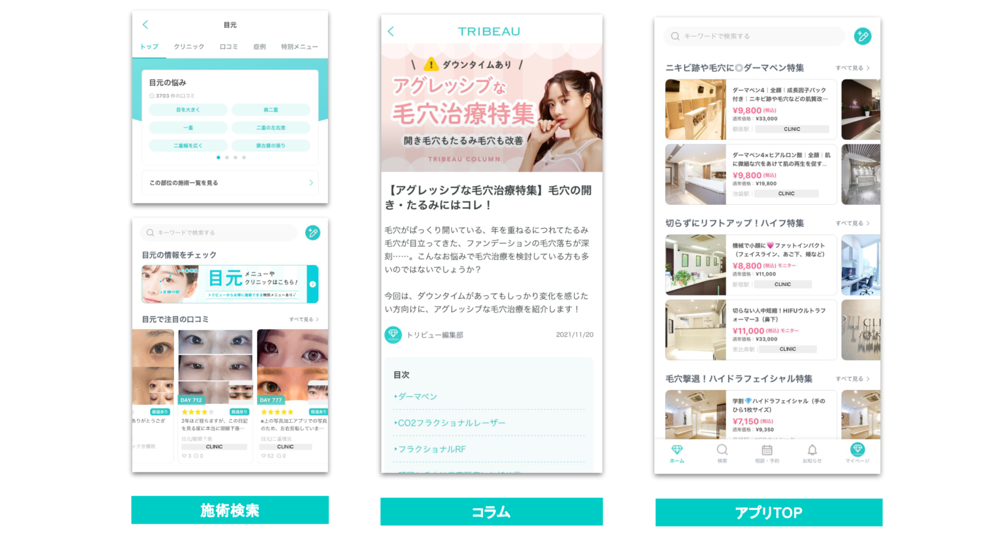 アプリの画面が3つ表示されています。左側は検索機能、中央は毛穴治療の特集、右側は美容クリニックのリストです。