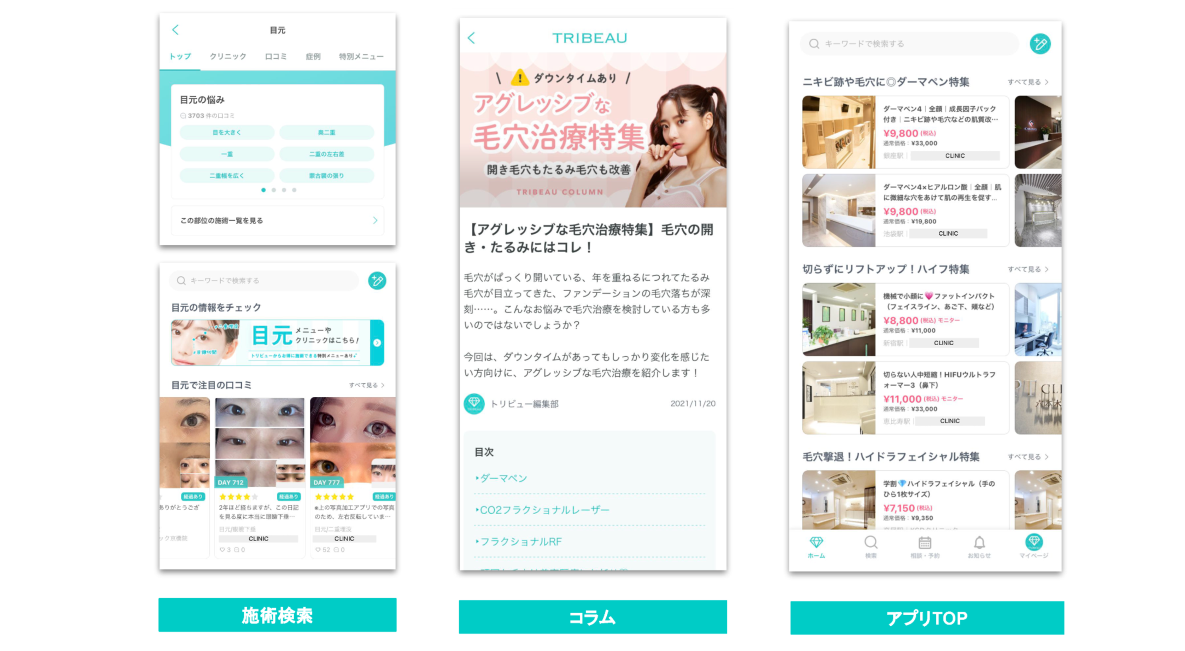 アプリの画面が3つ表示されています。左側は検索機能、中央は毛穴治療の特集、右側は美容クリニックのリストです。