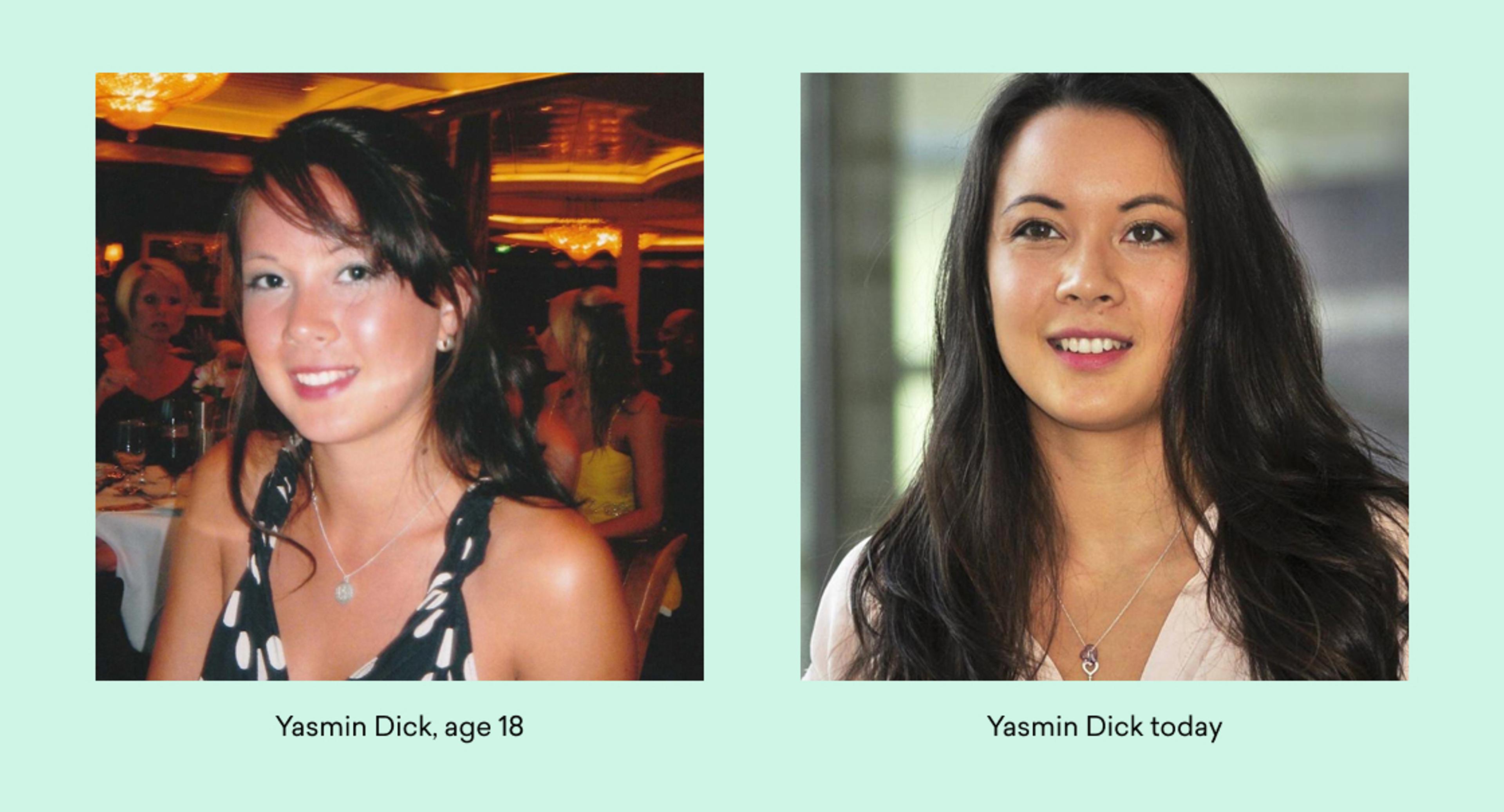 A side-by-side comparison of Yasmin Dick at age 18 and her current appearance. The left image shows her at a dinner, while the right image features her in a modern setting.