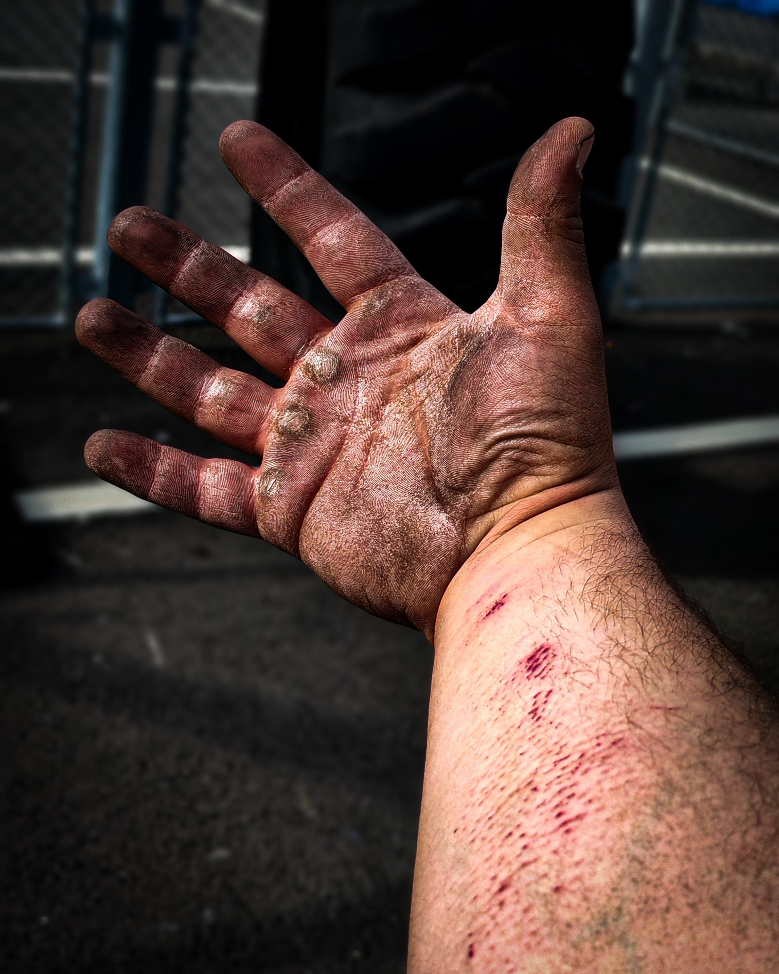 grip-fingers