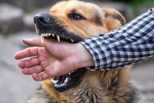 How To File A Claim For a Dog Bite In New Jersey