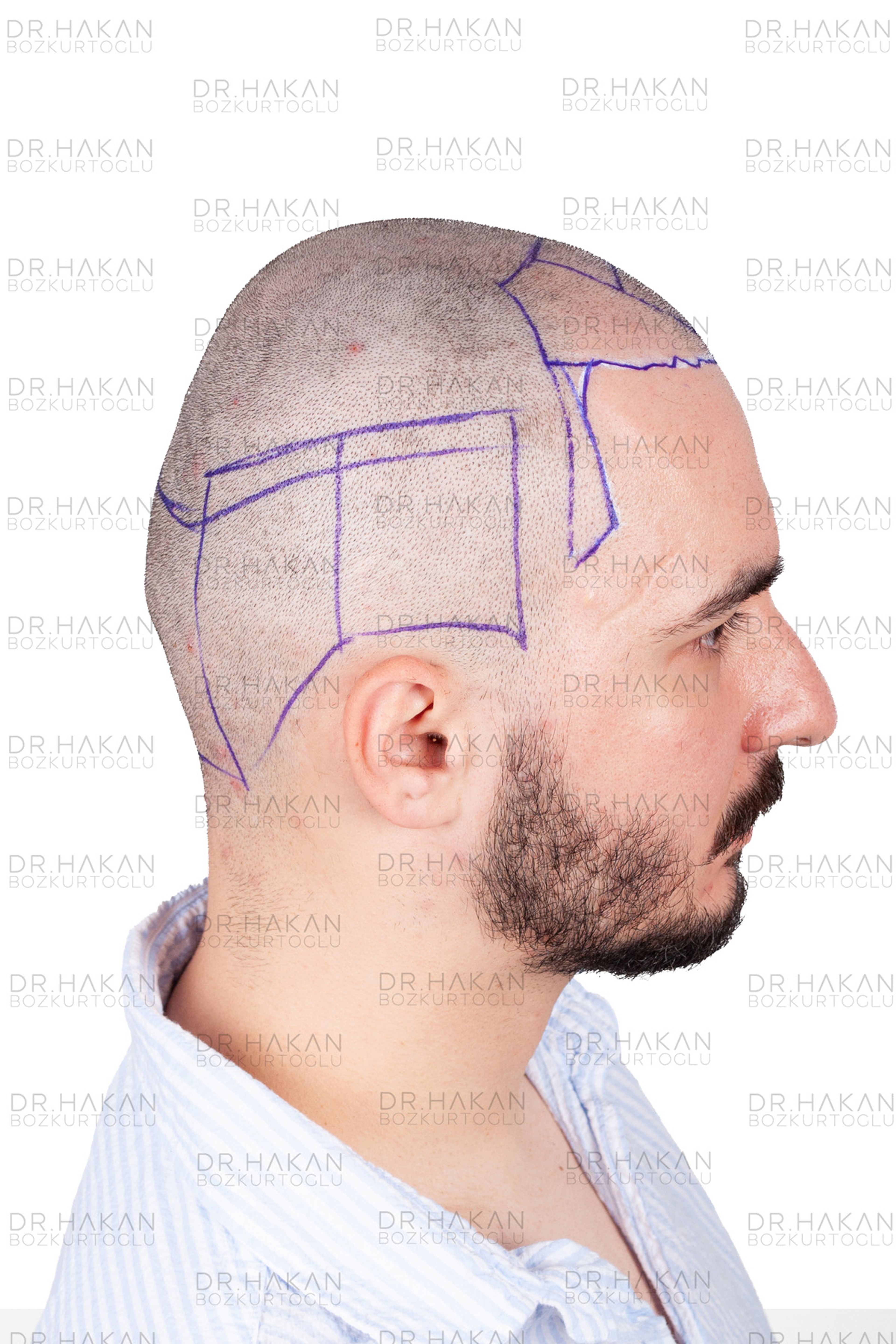 before - planning