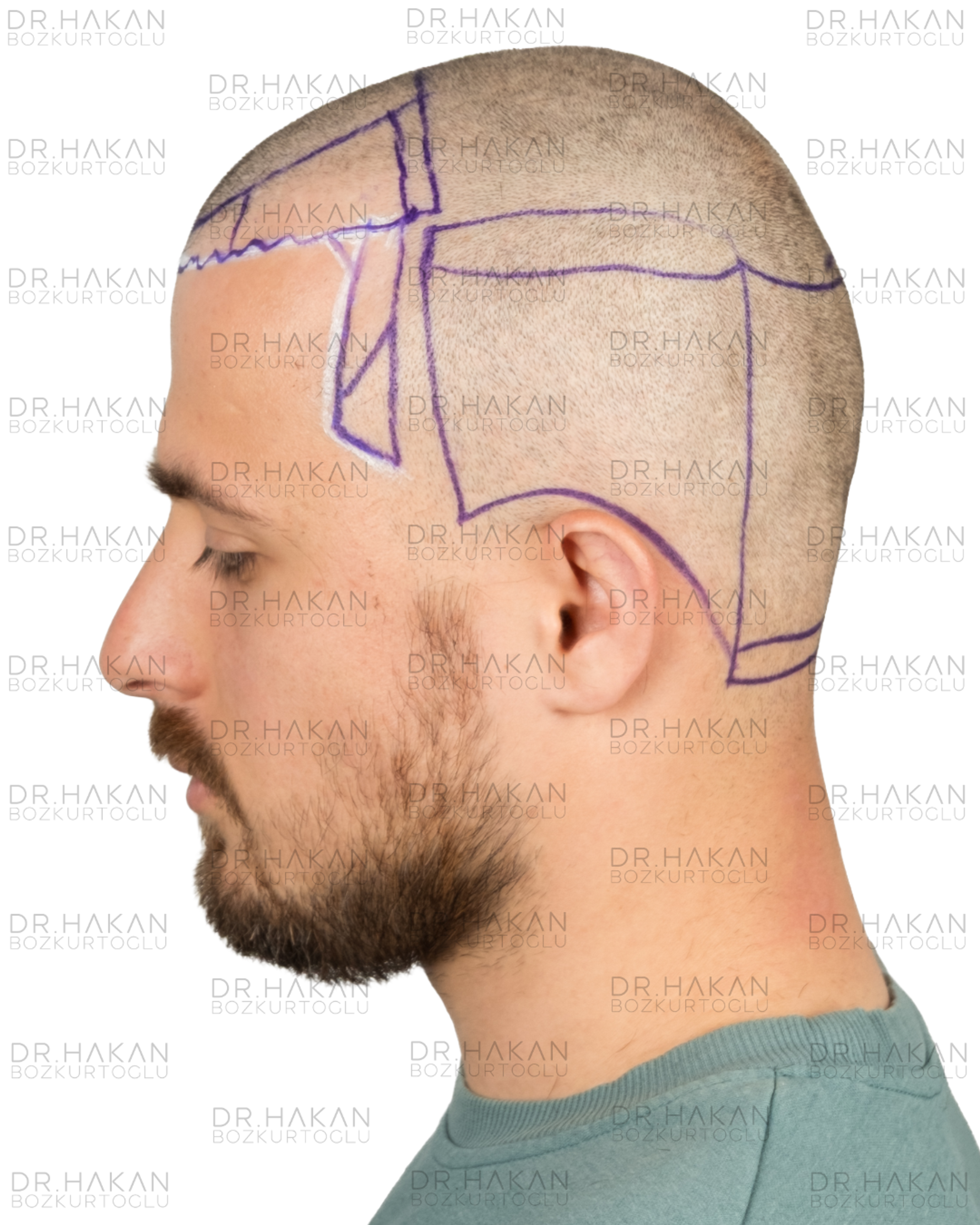before - planning