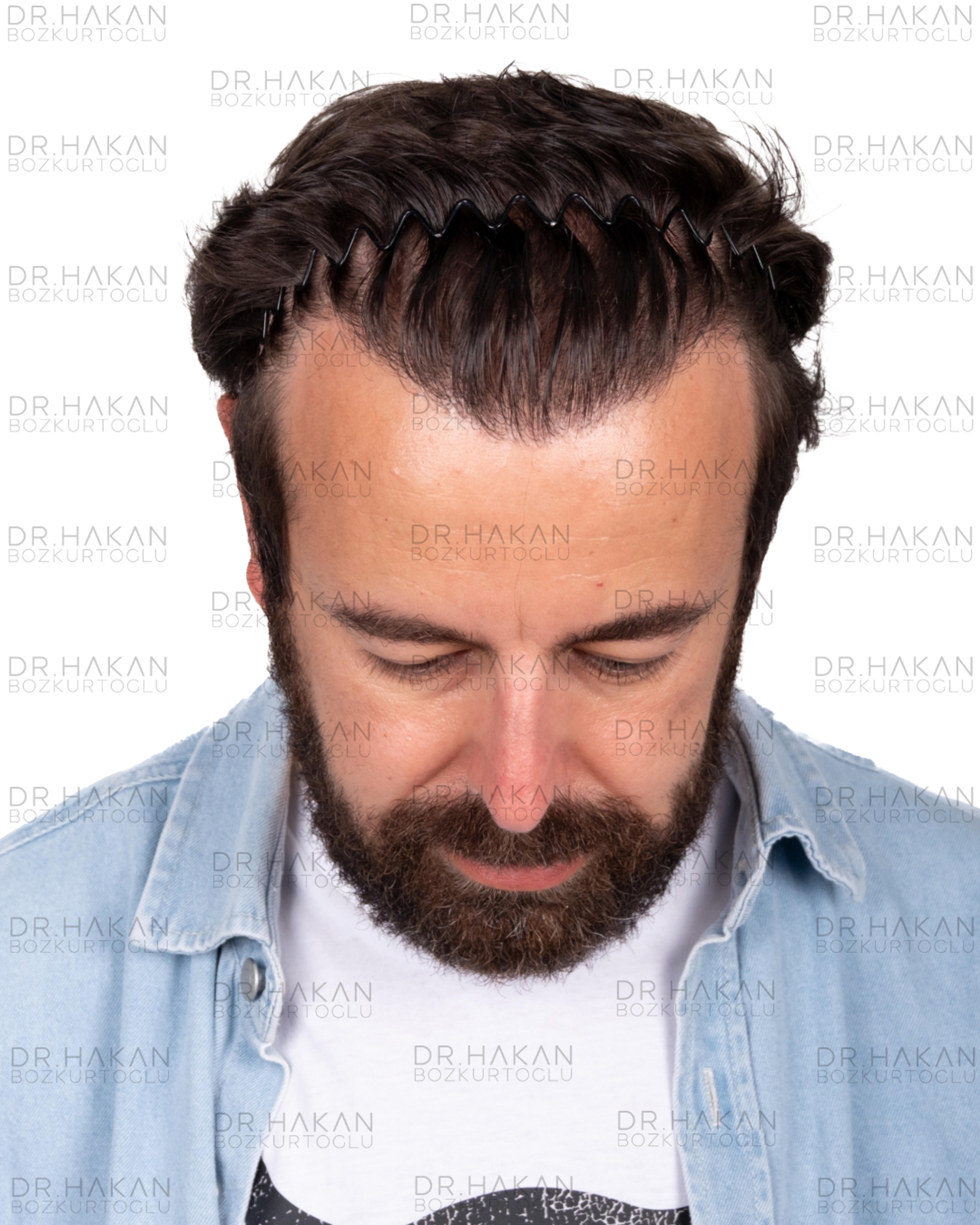 12 months wet hair
