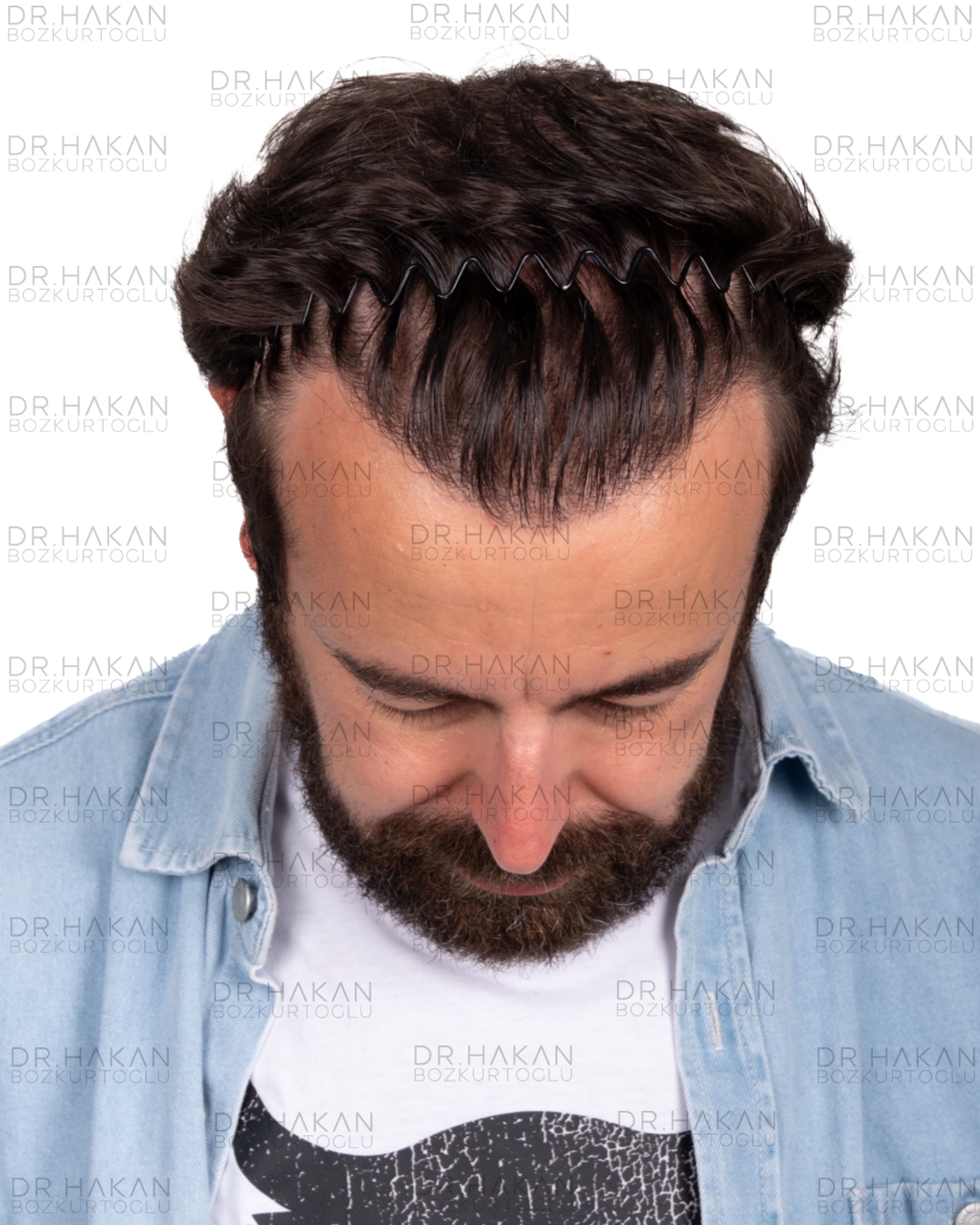 12 months wet hair