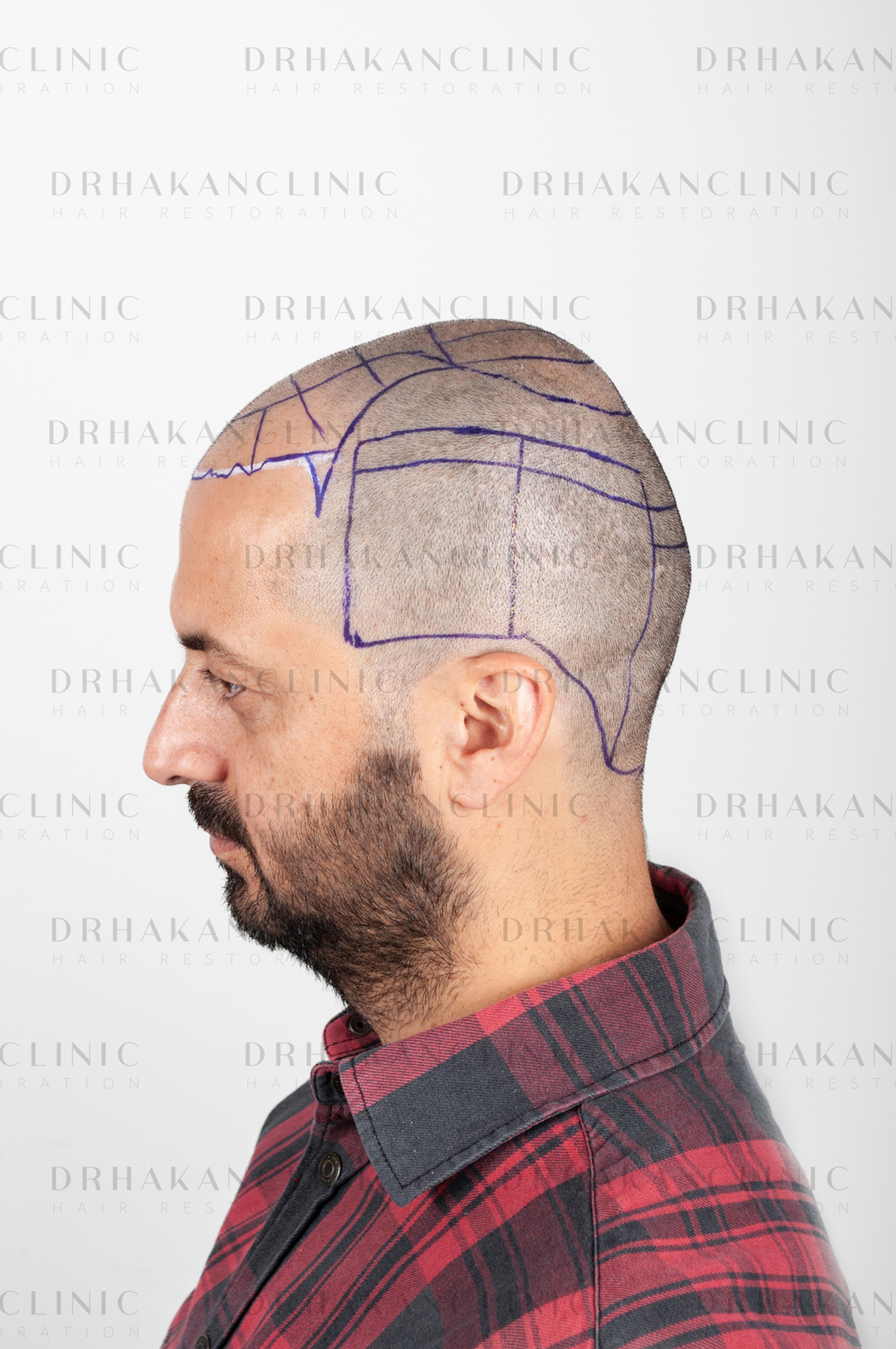 before - planning