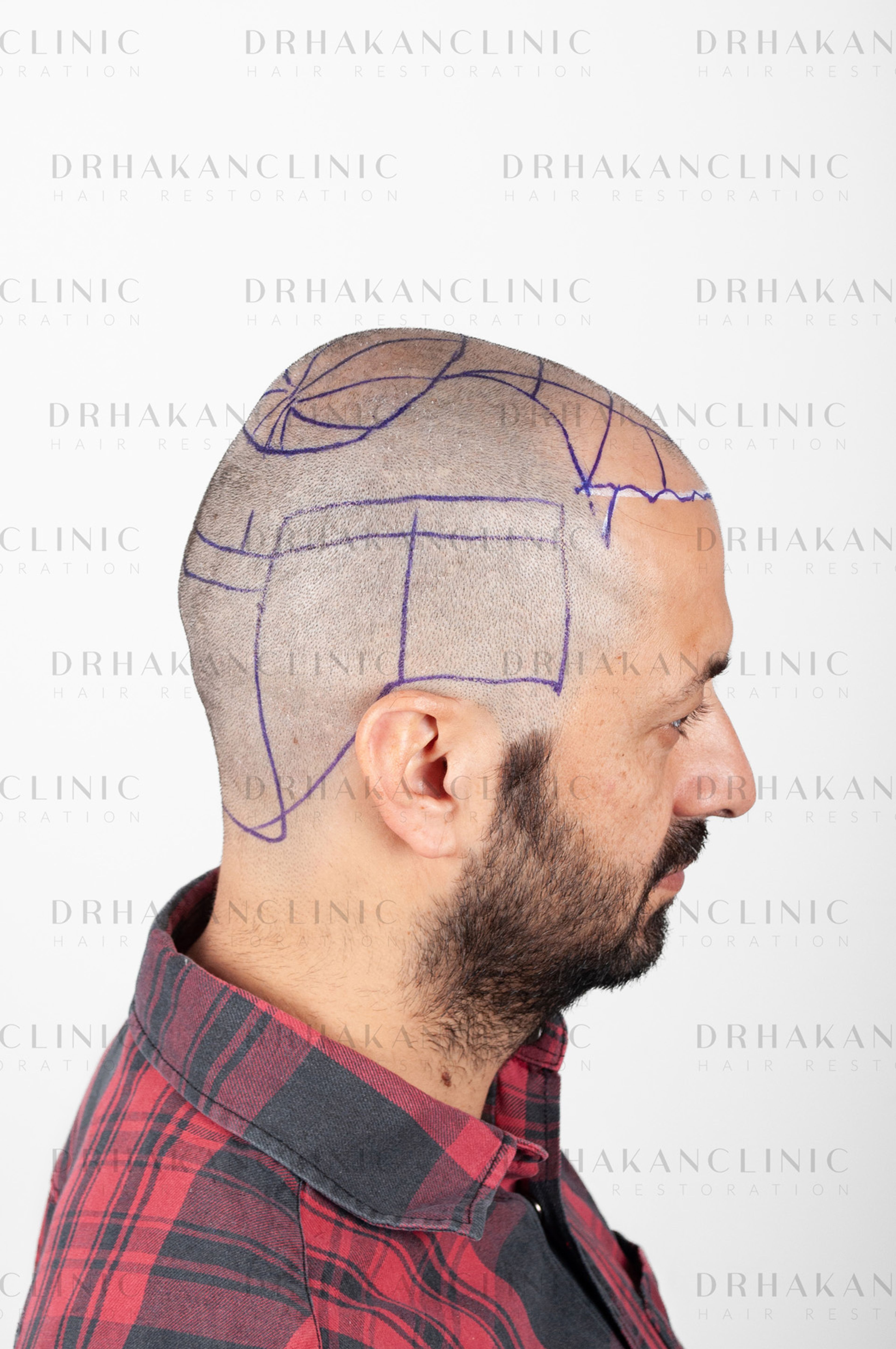 before - planning