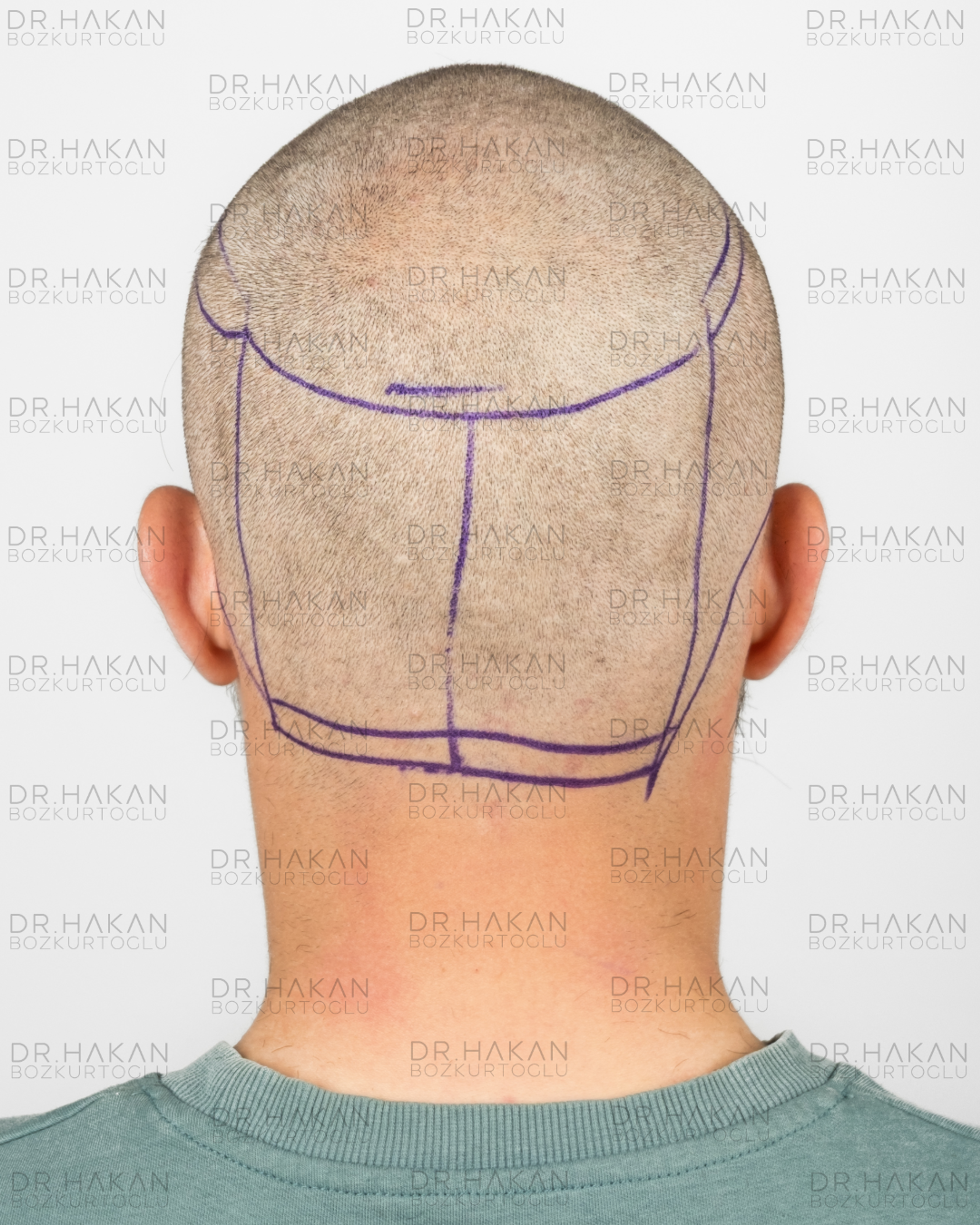 before - planning