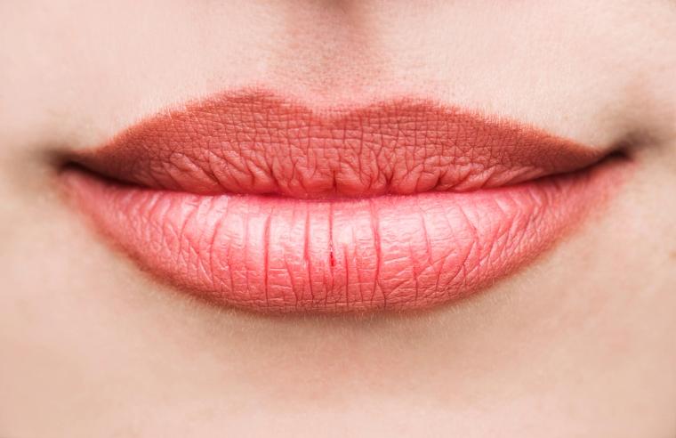 Fordyce Spots on the Lips: What They Are and How We Treat Them in Irvine