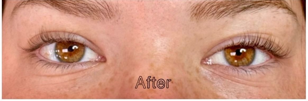 Lash Lift after — Fine Lashes, Light-Colored Lashes, Flat Lash Line, Sparse-Looking Lashes, front view