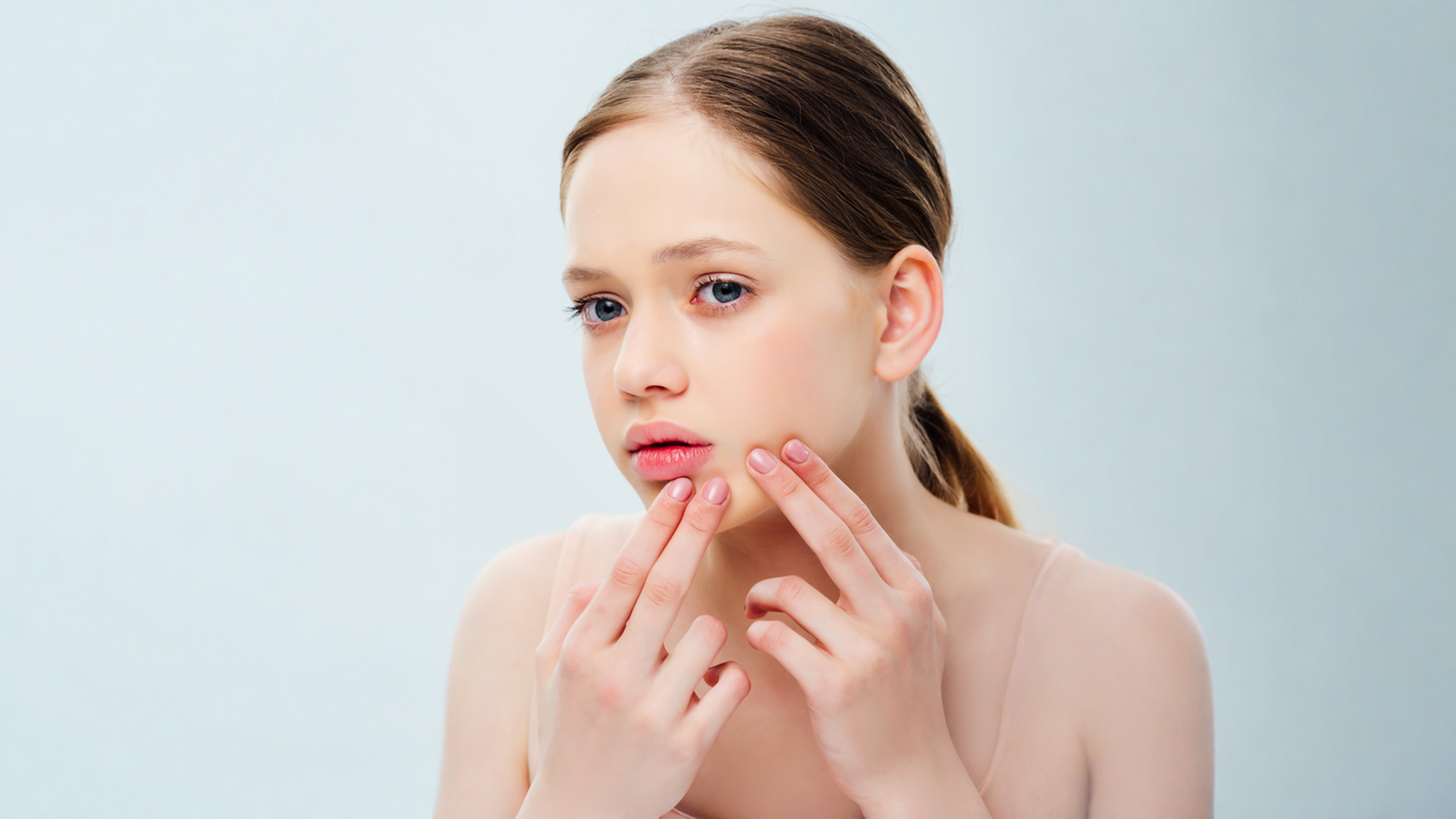 Acne Facial