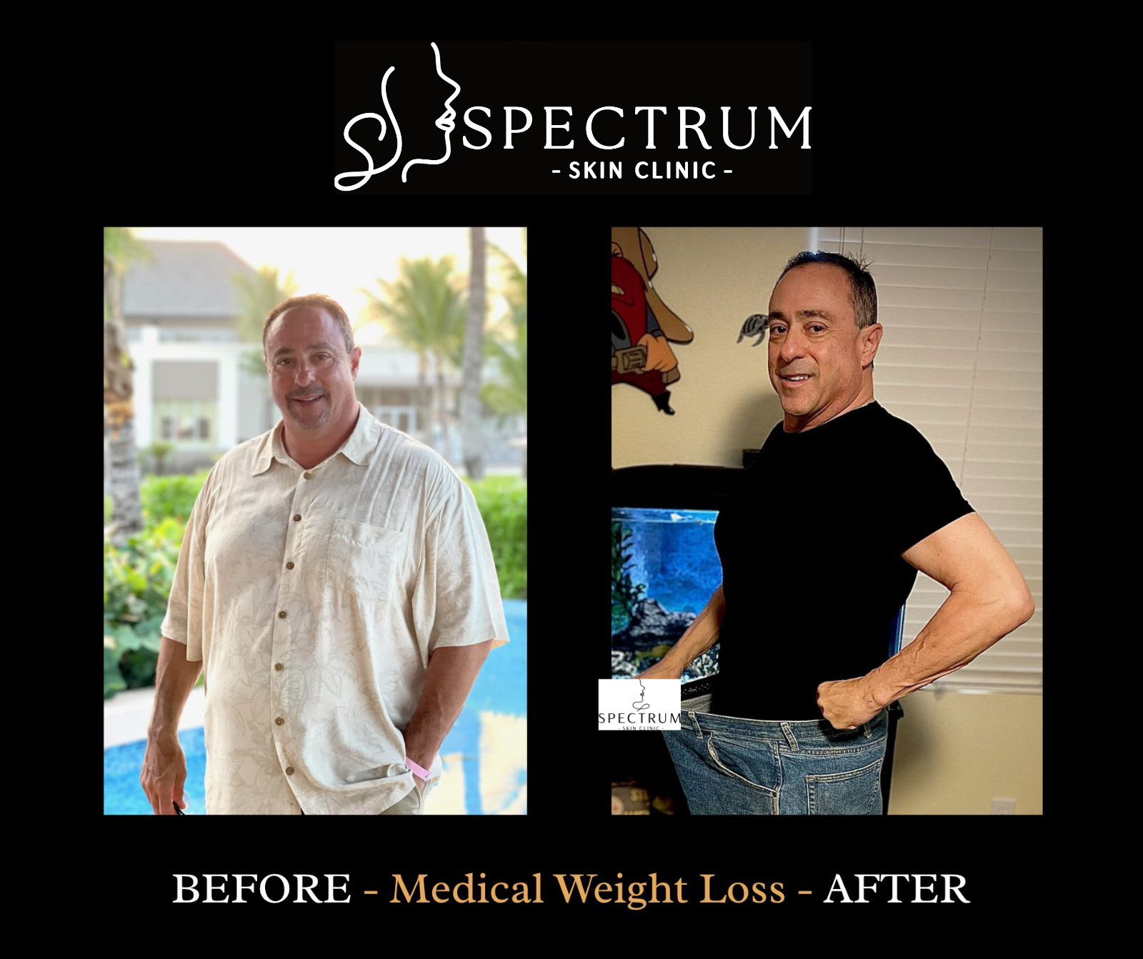 Medical Weight Loss Before and After | Body Composition Change