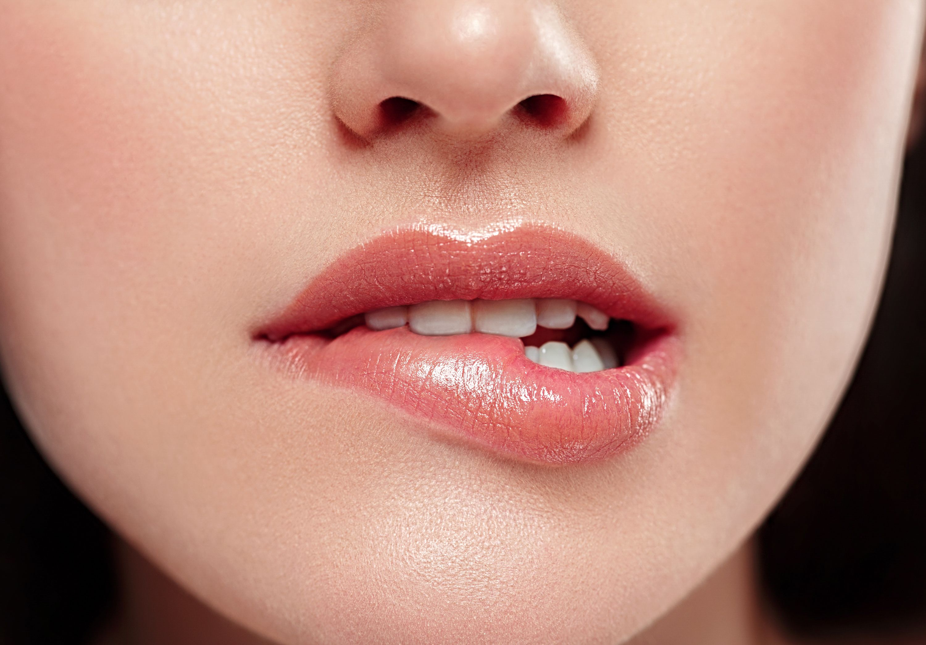 Lip Filler