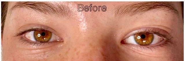 Lash Lift Before & After | Fine, Light-Colored Lashes Given Visible Shape — before