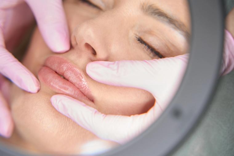Filler Migration: Signs, Causes, and How It Is Corrected