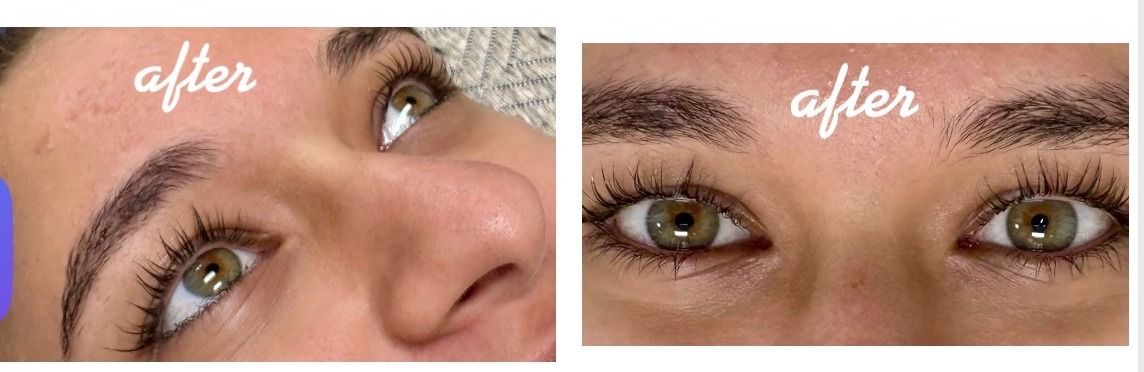 Lash Lift after — Straight Lashes, Downward-Pointing Lashes, Lashes Hidden Against the Lid, front view
