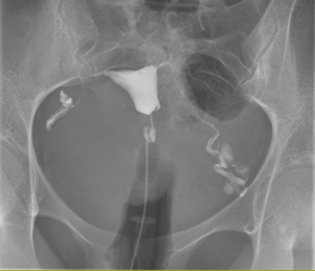 Zdjęcie poglądowe usługi: Histerosalpingografia