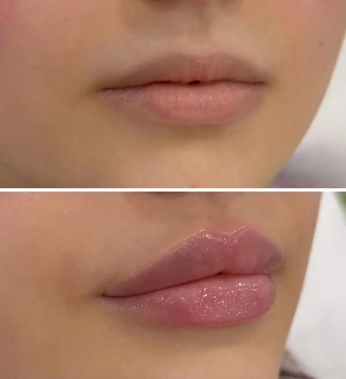 Красота начинается с заботы о себе! | Косметология | Костанай | 2