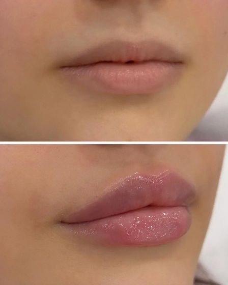 Красота начинается с заботы о себе! | Косметология | Костанай | 2