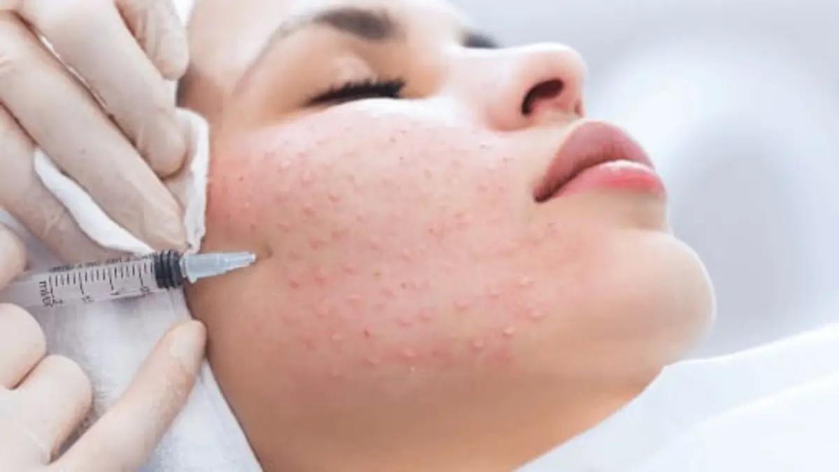 Красота начинается с заботы о себе! | Косметология | Костанай | 3