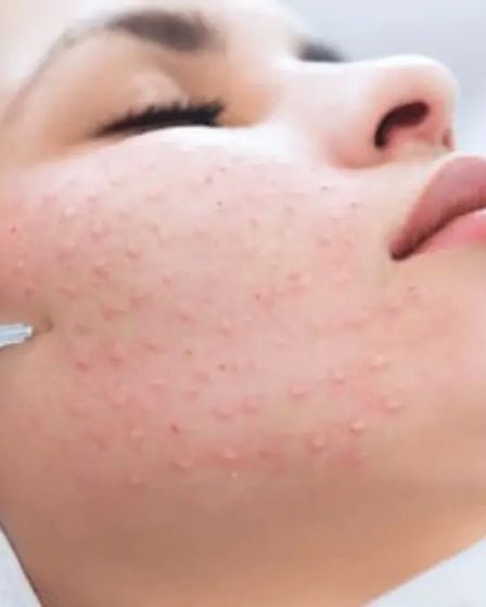 Красота начинается с заботы о себе! | Косметология | Костанай | 3