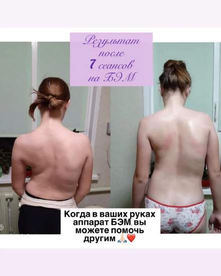 ОРГАНЫ ПОД ЗАЩИТОЙ БИОЭНЕРГИИ. | Массаж | Алматы | 6