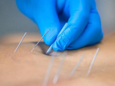 Hijama.top - 3