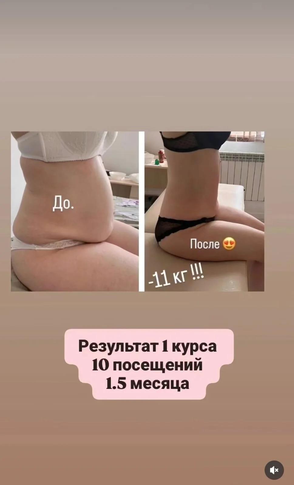 Студия коррекции фигуры | Массаж | Астана | 2