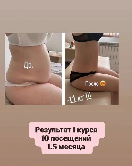 Студия коррекции фигуры | Массаж | Астана | 2